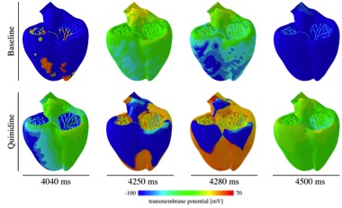 Figure 5: Evolution of the electrical activity for the baseline case (no drug) and after the application of the drug Quinidine. The electrical propagation turns chaotic after the drug is applied, showing the high risk of Quinidine to produce arrhythmias.